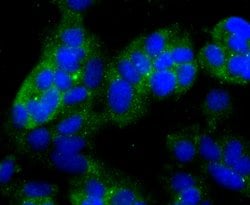 Invitrogen NDRG1 Recombinant Rabbit Monoclonal Antibody (JM32-02) 100 &mu;L;