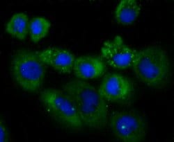 Invitrogen NDRG1 Recombinant Rabbit Monoclonal Antibody (JM32-02) 100 &mu;L;