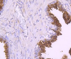 Invitrogen NDRG1 Recombinant Rabbit Monoclonal Antibody (JM32-02) 100 &mu;L;