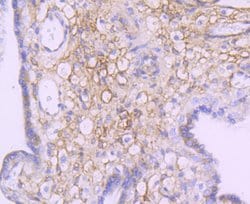 Invitrogen NDRG1 Recombinant Rabbit Monoclonal Antibody (JM32-02) 100 &mu;L;