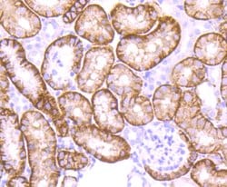 Invitrogen NDRG1 Recombinant Rabbit Monoclonal Antibody (JM32-02) 100 &mu;L;