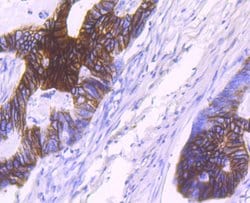 Invitrogen NDRG1 Recombinant Rabbit Monoclonal Antibody (JM32-02) 100 &mu;L;