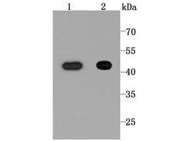 Invitrogen NDRG1 Recombinant Rabbit Monoclonal Antibody (JM32-02) 100 &mu;L;