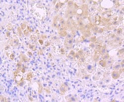 Invitrogen INSRR Recombinant Rabbit Monoclonal Antibody (JM22-38) 100 &mu;L;