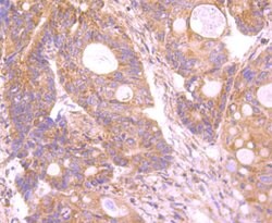 Invitrogen INSRR Recombinant Rabbit Monoclonal Antibody (JM22-38) 100 &mu;L;