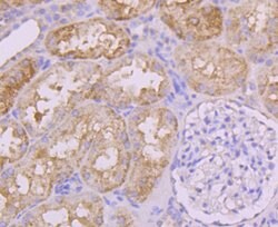 Invitrogen INSRR Recombinant Rabbit Monoclonal Antibody (JM22-38) 100 &mu;L;