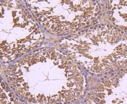 Invitrogen INSRR Recombinant Rabbit Monoclonal Antibody (JM22-38) 100 &mu;L;