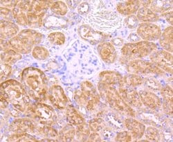Invitrogen INSRR Recombinant Rabbit Monoclonal Antibody (JM22-38) 100 &mu;L;