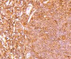 Invitrogen ETS1 Recombinant Rabbit Monoclonal Antibody (JM92-32) 100 &mu;L;
