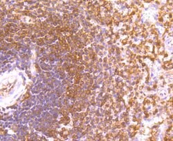 Invitrogen ETS1 Recombinant Rabbit Monoclonal Antibody (JM92-32) 100 &mu;L;