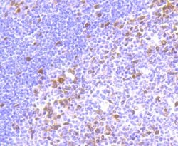 Invitrogen Thymidylate Synthase Recombinant Rabbit Monoclonal Antibody (JM33-20) 100 &mu;L | Buy Online | Invitrogen&trade; | Fisher Scientific