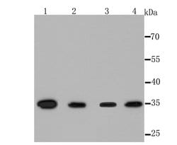Invitrogen Thymidylate Synthase Recombinant Rabbit Monoclonal Antibody (JM33-20) 100 &mu;L | Buy Online | Invitrogen&trade; | Fisher Scientific