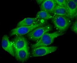 Invitrogen CYP2D6 Recombinant Rabbit Monoclonal Antibody (JM44-23) 100