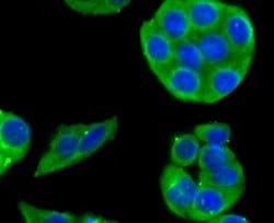 Invitrogen CYP2D6 Recombinant Rabbit Monoclonal Antibody (JM44-23) 100