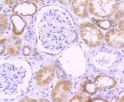 Invitrogen CYP2D6 Recombinant Rabbit Monoclonal Antibody (JM44-23) 100
