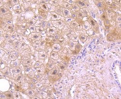 Invitrogen Protein C Recombinant Rabbit Monoclonal Antibody (JM93-61) 100