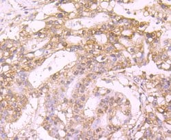Invitrogen Protein C Recombinant Rabbit Monoclonal Antibody (JM93-61) 100