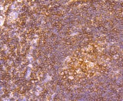 Invitrogen TUBA4A Recombinant Rabbit Monoclonal Antibody (JM73-24) 100