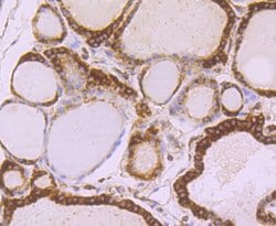 Invitrogen TUBA4A Recombinant Rabbit Monoclonal Antibody (JM73-24) 100