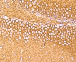 Invitrogen TUBA4A Recombinant Rabbit Monoclonal Antibody (JM73-24) 100