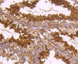 Invitrogen TUBA4A Recombinant Rabbit Monoclonal Antibody (JM73-24) 100