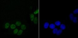 Invitrogen DDX5 Recombinant Rabbit Monoclonal Antibody (JM32-50) 100 &mu;L;
