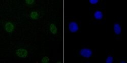 Invitrogen DDX5 Recombinant Rabbit Monoclonal Antibody (JM32-50) 100 &mu;L;