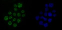 Invitrogen DDX5 Recombinant Rabbit Monoclonal Antibody (JM32-50) 100 &mu;L;