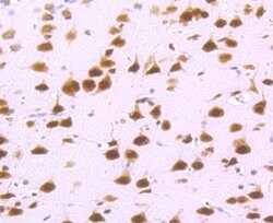 Invitrogen DDX5 Recombinant Rabbit Monoclonal Antibody (JM32-50) 100 &mu;L;