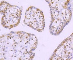 Invitrogen DDX5 Recombinant Rabbit Monoclonal Antibody (JM32-50) 100 &mu;L;