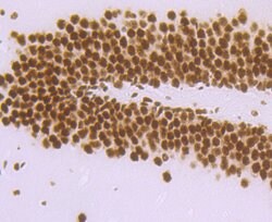 Invitrogen DDX5 Recombinant Rabbit Monoclonal Antibody (JM32-50) 100 &mu;L;