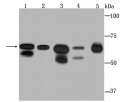 Invitrogen DDX5 Recombinant Rabbit Monoclonal Antibody (JM32-50) 100 &mu;L;