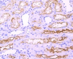Invitrogen ACE Recombinant Rabbit Monoclonal Antibody (JM59-32) 100 &mu;L;