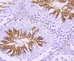 Invitrogen ACE Recombinant Rabbit Monoclonal Antibody (JM59-32) 100 &mu;L;