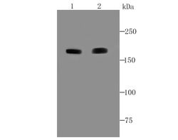Invitrogen ACE Recombinant Rabbit Monoclonal Antibody (JM59-32) 100 &mu;L;