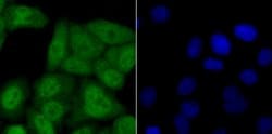 Invitrogen USP11 Recombinant Rabbit Monoclonal Antibody (JM33-62) 100 &mu;L;