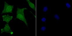 Invitrogen USP11 Recombinant Rabbit Monoclonal Antibody (JM33-62) 100 &mu;L;