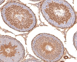 Invitrogen USP11 Recombinant Rabbit Monoclonal Antibody (JM33-62) 100 &mu;L;
