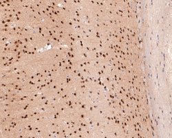 Invitrogen USP11 Recombinant Rabbit Monoclonal Antibody (JM33-62) 100 &mu;L;