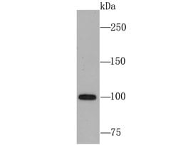 Invitrogen USP11 Recombinant Rabbit Monoclonal Antibody (JM33-62) 100 &mu;L;