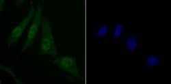 Invitrogen SKP1 Recombinant Rabbit Monoclonal Antibody (JM27-37) 100 &mu;L;