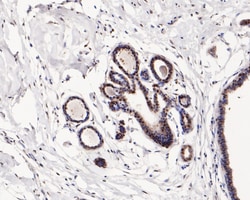 Invitrogen SKP1 Recombinant Rabbit Monoclonal Antibody (JM27-37) 100 &mu;L;