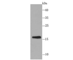 Invitrogen SKP1 Recombinant Rabbit Monoclonal Antibody (JM27-37) 100 &mu;L;