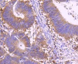 Invitrogen c-Rel Recombinant Rabbit Monoclonal Antibody (JM72-93) 100 &mu;L;