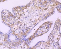 Invitrogen c-Rel Recombinant Rabbit Monoclonal Antibody (JM72-93) 100 &mu;L;