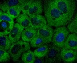 Invitrogen NFkB p100 Recombinant Rabbit Monoclonal Antibody (JM82-03) 100