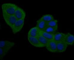 Invitrogen NFkB p100 Recombinant Rabbit Monoclonal Antibody (JM82-03) 100