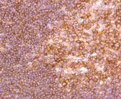 Invitrogen NFkB p100 Recombinant Rabbit Monoclonal Antibody (JM82-03) 100