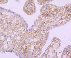 Invitrogen NFkB p100 Recombinant Rabbit Monoclonal Antibody (JM82-03) 100