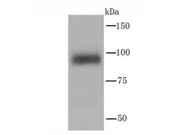 Invitrogen PIK3CD Recombinant Rabbit Monoclonal Antibody (JM83-24) 100 &mu;L | Buy Online | Invitrogen&trade; | Fisher Scientific